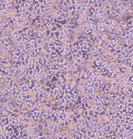 HepG2细胞;人肝癌细胞		