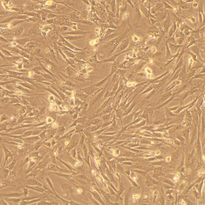 MEF细胞;小鼠胚胎成纤维细胞