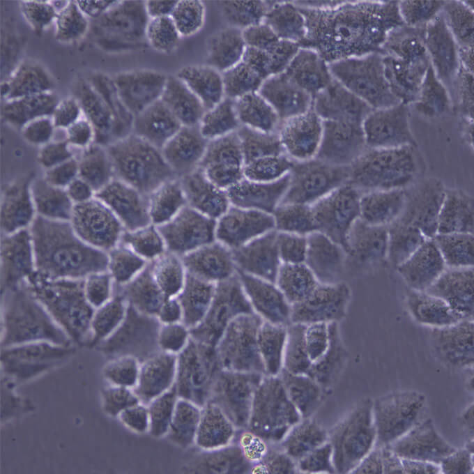 NCI-H460细胞;人大细胞肺癌细胞