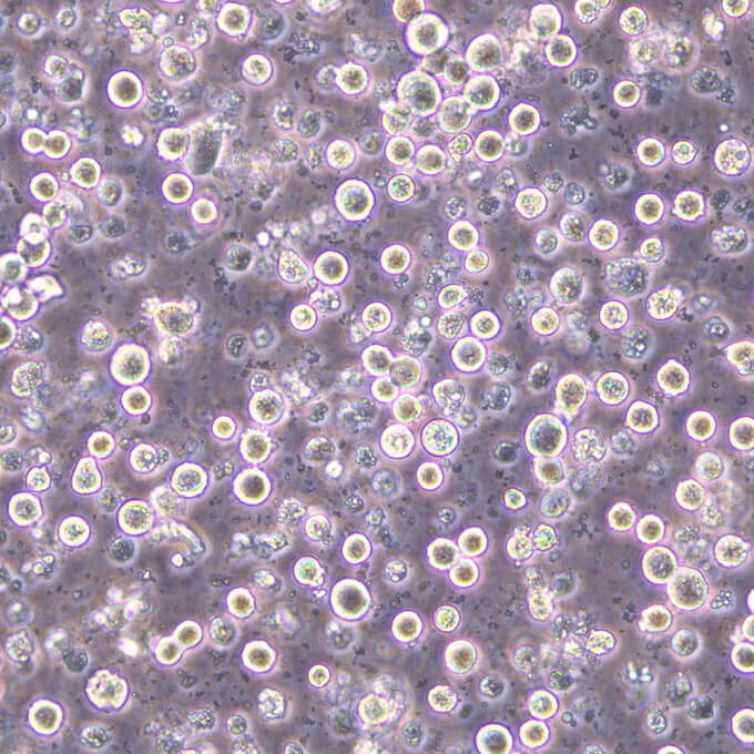 SK-BR-3细胞;人乳腺癌细胞