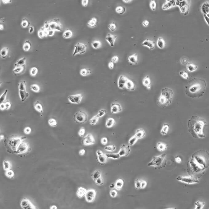 SK-MEL-28细胞;人皮肤恶性黑色素瘤细胞