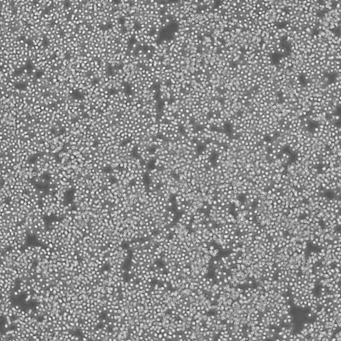 RamosRA.1细胞;人B淋巴细胞瘤细胞