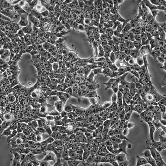 【热销】293A细胞;人胚肾细胞