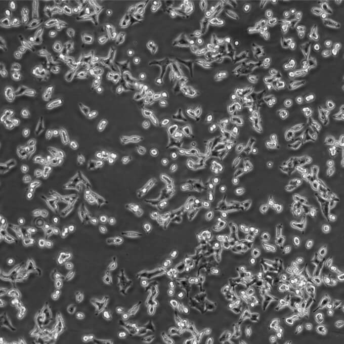 MIN6细胞;小鼠胰岛β细胞株