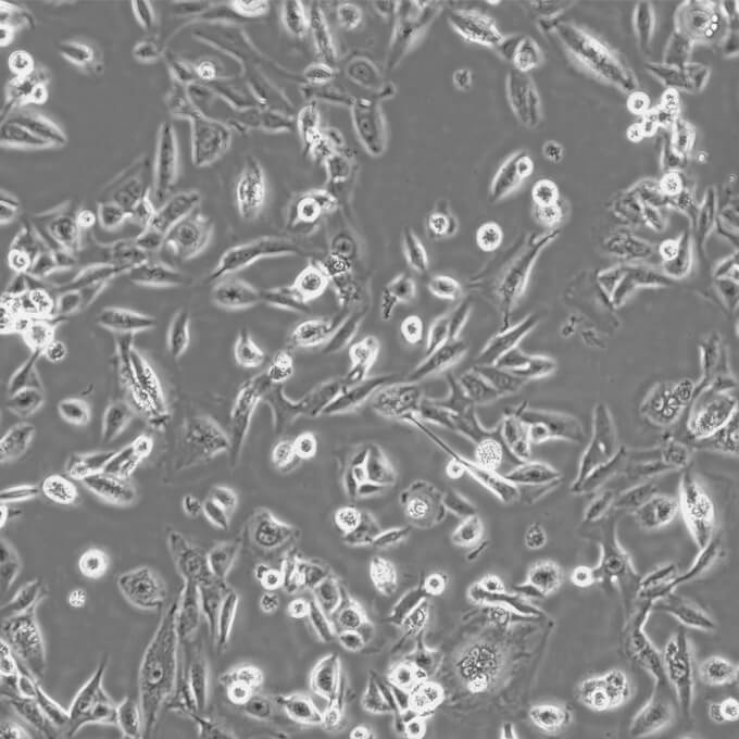 MDA-MB-435S细胞;人乳腺导管癌细胞