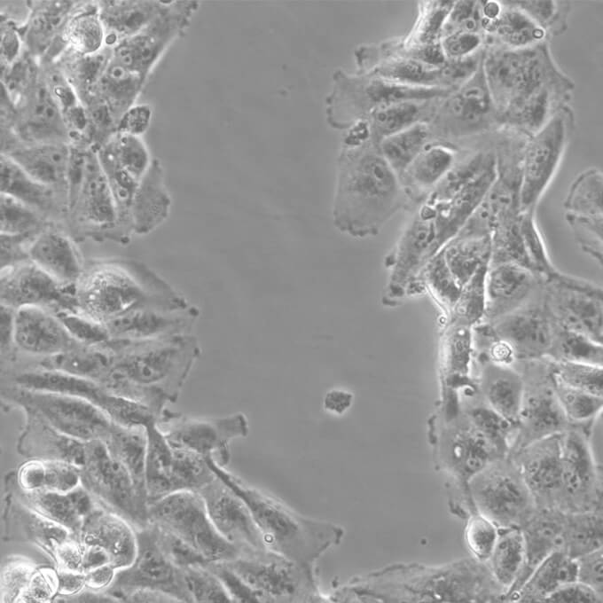 NCI-H295R细胞;人肾上腺皮质腺癌细胞